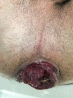 Semi nudo e genitali