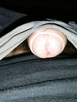 Quando spinge per uscire...