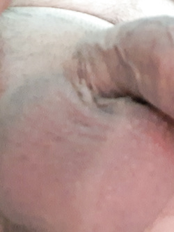 Sempre pronto Parte 2