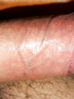 Appena svegliato parte seconda