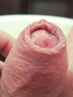 La fonte del piacere