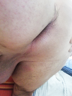 Buco vergine Parte 2