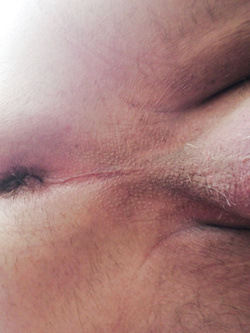 Seghe e culi Parte 2