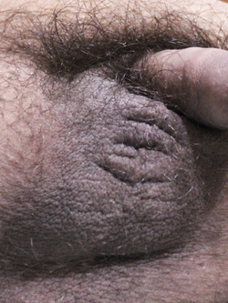 Giorni di quarantena