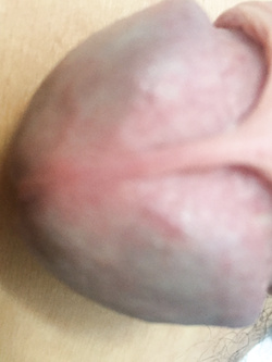 Il mio Pisello Parte 2