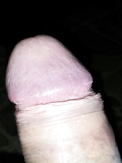 Qualcuno si lamenta della bottiglia