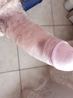 Lo strumento del "dottore".