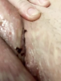 Col ciclo ho piu’ voglia e ho le tette dure come sassi