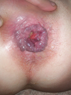 un culetto sfondato...