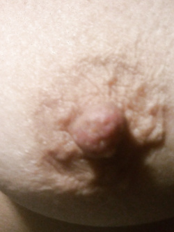 Figotta e capezzoli 2