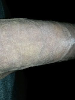 Depilazione primaverile