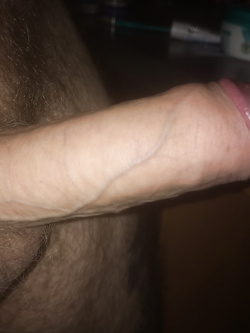My Dick
