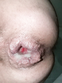 anal cum