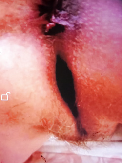 Marta sborratoio (si invita ad pubblicare )