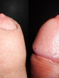 COPERTO O SCAPPELLATO. COME LO PREFERISCI ??