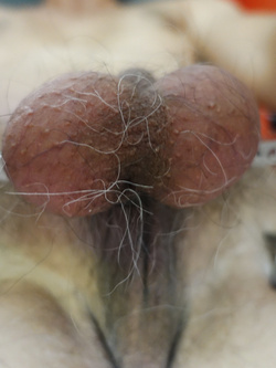 Stiramento e allungo