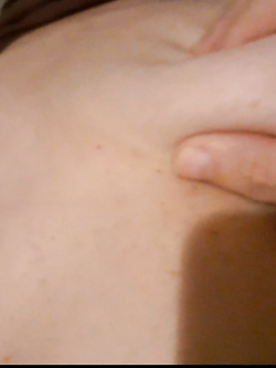 Mia moglie viene visitata da un medico - prima parte