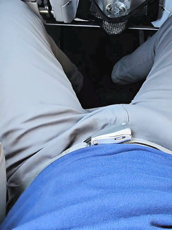 Grossi rigonfiamenti naturali