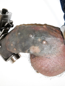 cazzo pene chiuso a chiave in castità