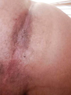 Il mio culo Parte 20