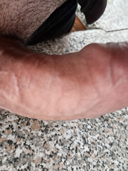 Il mio pisello Parte 11