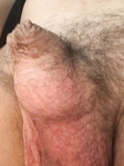 Timido Giovane (piccolo pene?)