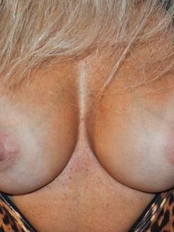 55 enne con culo rotto