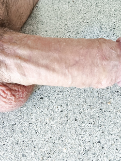 Il mio pene Parte 25