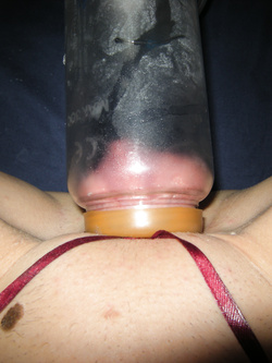 figa pompata alcuni anni fa