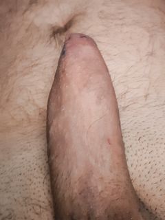 Sempre pronto Parte 2