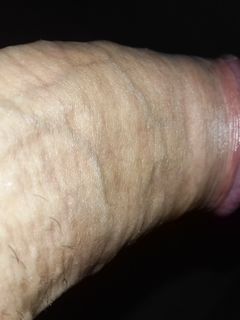 Il mio amico Parte 22